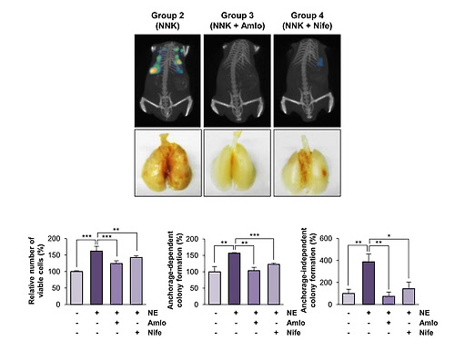 칼슘 채널 차단제를 투여한 쥐에서 폐 발암이 감소된 모습